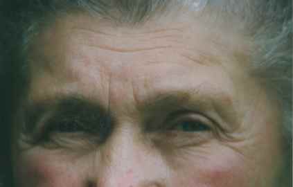 Augen